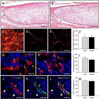 Adipose Tissue-Derived Microvascular Fragments From Male and Female Fat Donors Exhibit a Comparable Vascularization Capacity